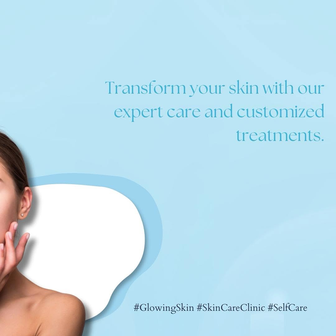 Side hairline FUE hair transplant — CosmoCare Vapi